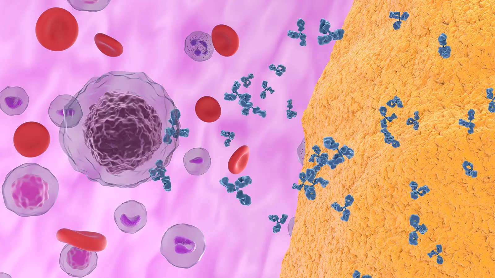 A computer rendering of B cells, autoantibodies, and bone.