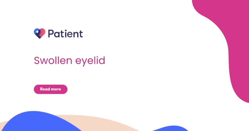 Swollen Eyelid: What Causes It and How to Treat It Swollen Eyelid: What Causes It and How to Treat It