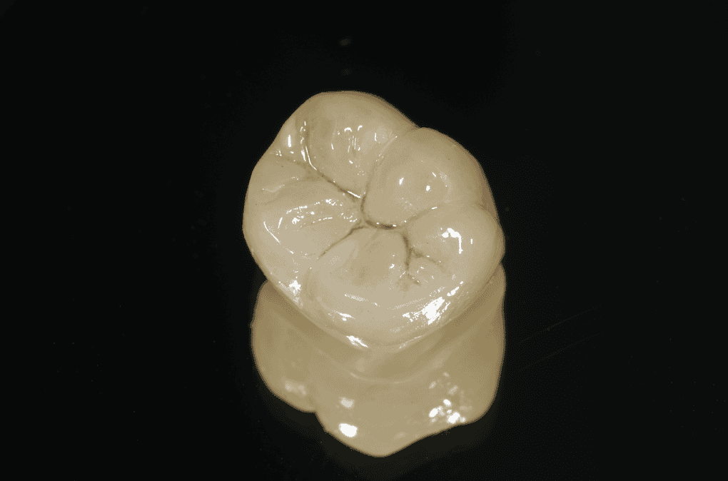 assured dental lab, Z-Brux™ Direct