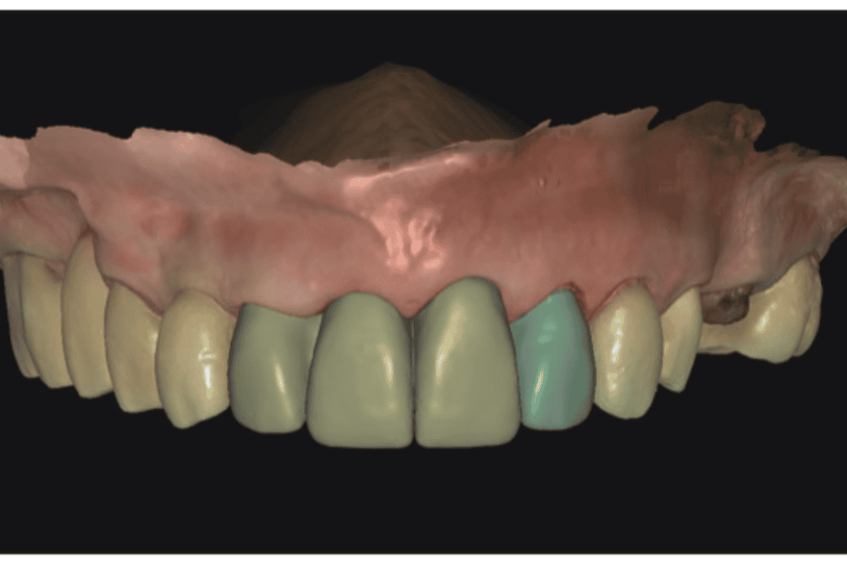 Digital Dentistry for the Win