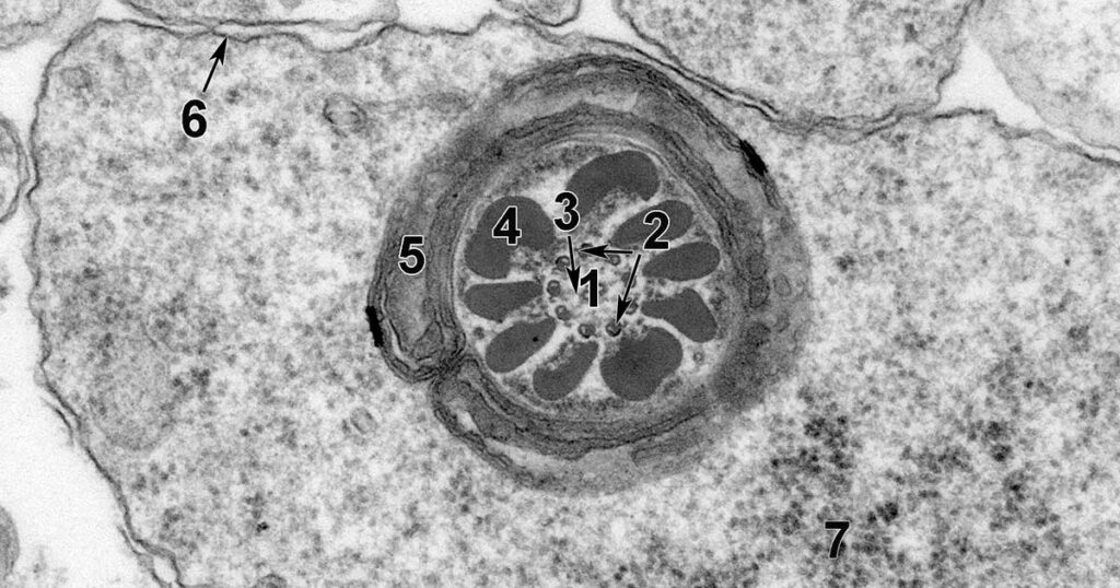 Environmental Factor – May 2025: First-of-its-kind atlas offers detailed look at rodent cells Environmental Factor - May 2025: First-of-its-kind atlas offers detailed look at rodent cells