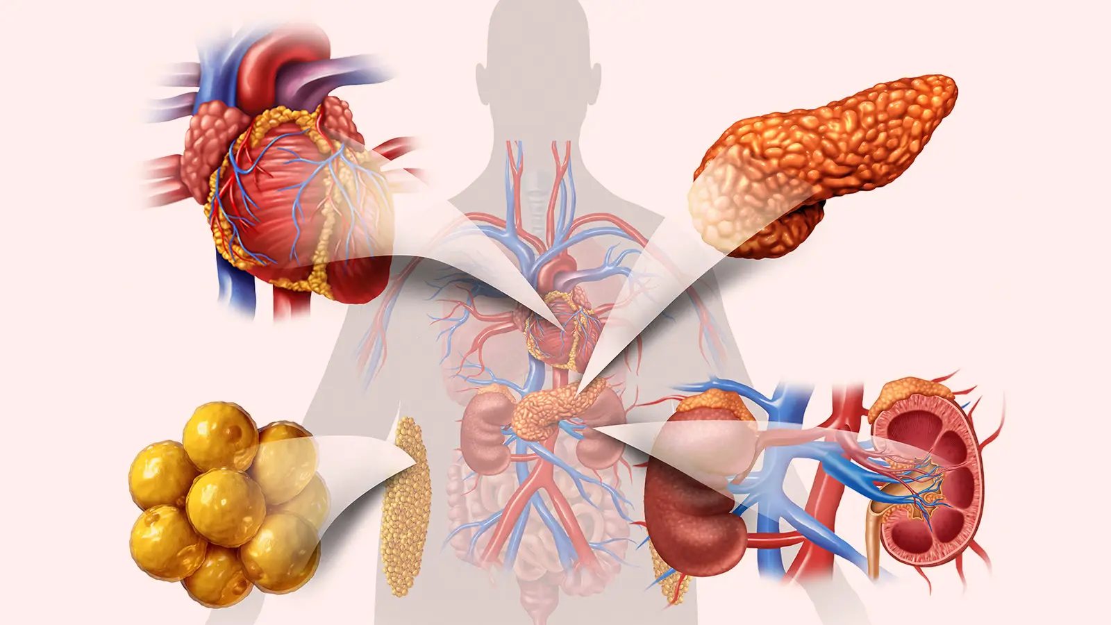 A computer rendering of a human figure with the heart, pancreas, kidneys and fat cells highlighted.