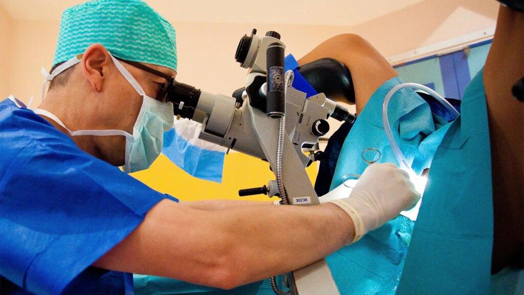 One Surgical Technique for Cervical Lesions May Reduce Recurrences A photo of a male surgeon during a conization procedure.