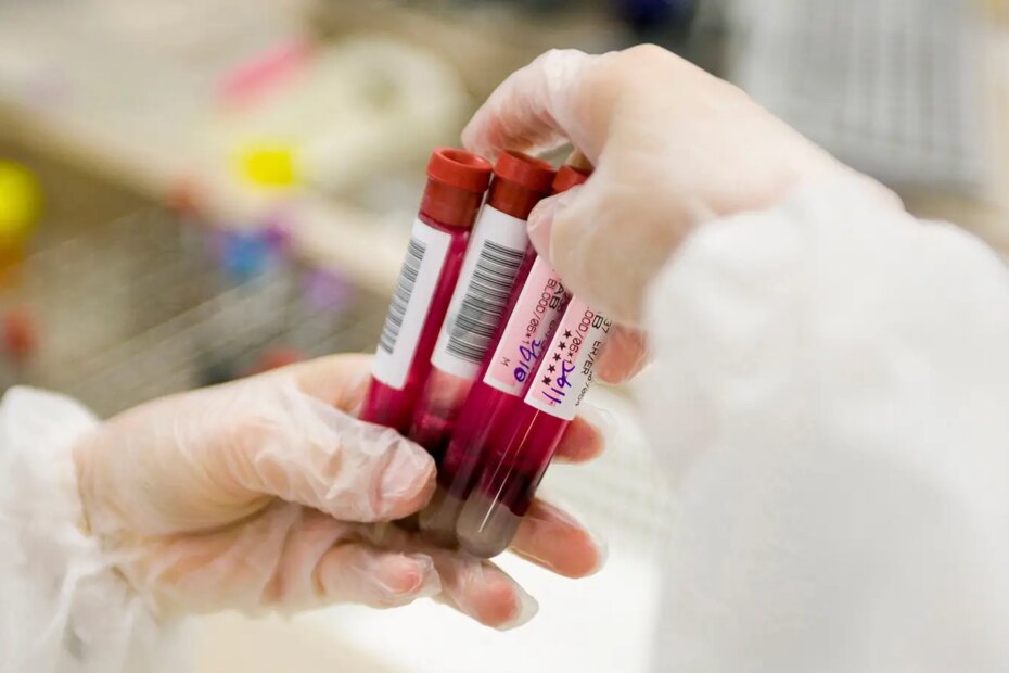 A photo of a lab technician holding four blood samples in test tubes.