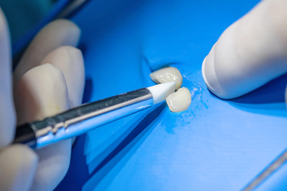 Restorative excellence at GC International Dental Symposium