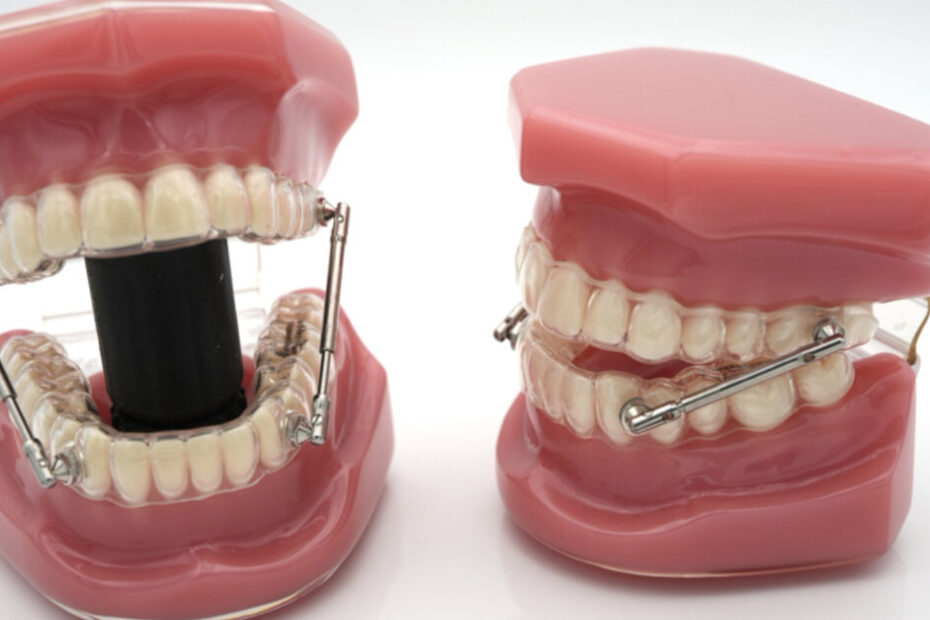 The orthocaps Rainmaker appliance