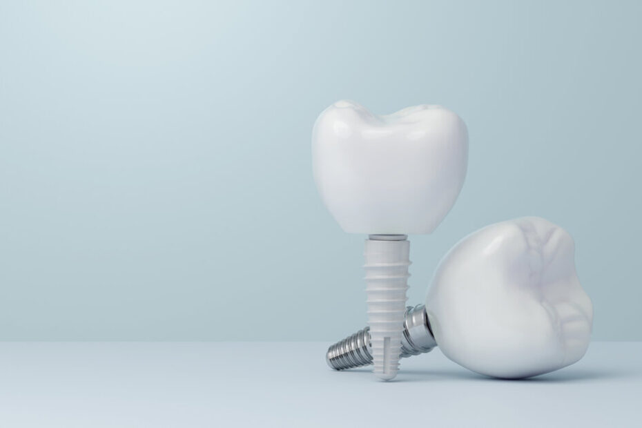 Zirconia dental implants show early immune activation