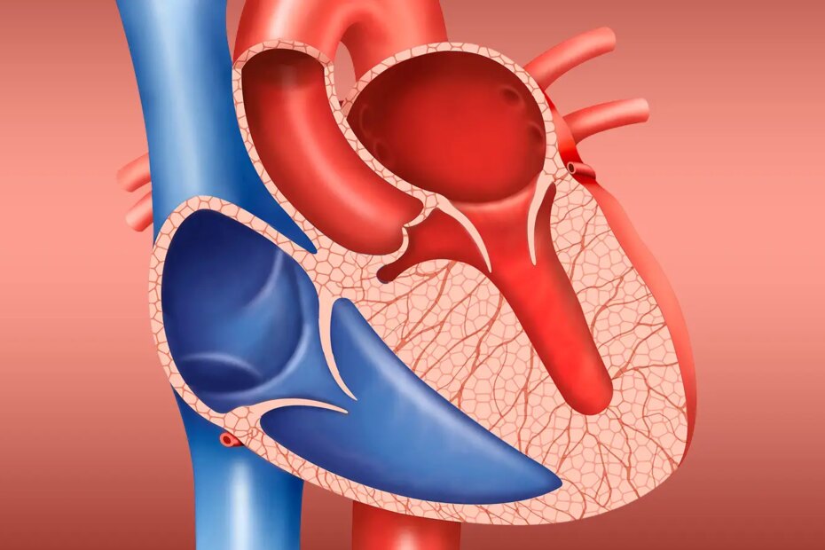 A computer rendering of hypertrophic cardiomyopathy.