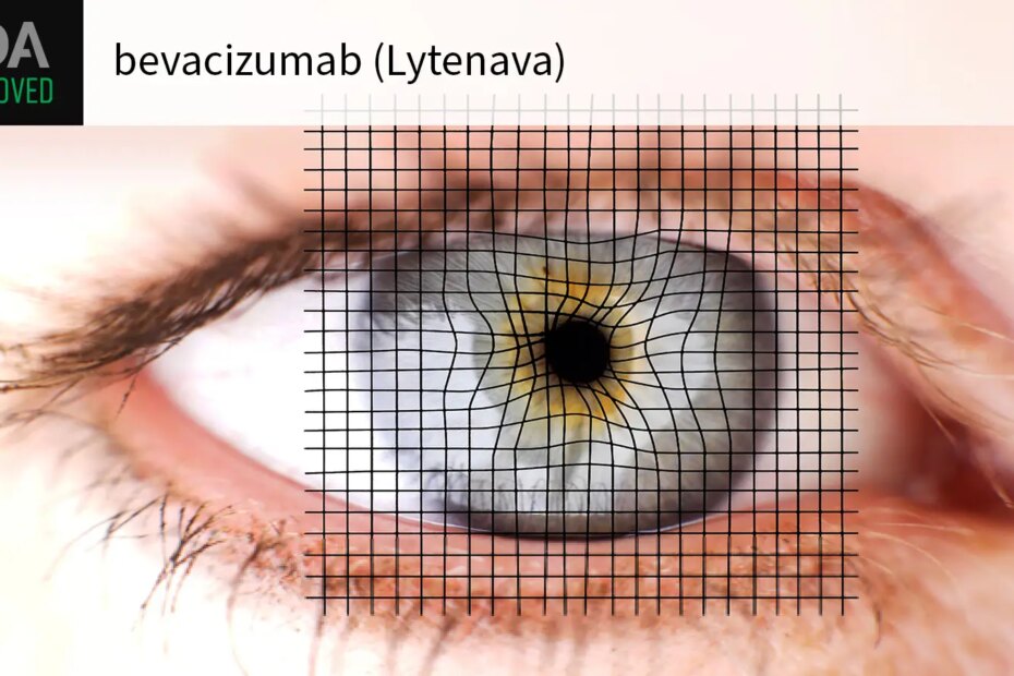 FDA APPROVED bevacizumab (Lytenava) over a photo of an Amsler grid over a woman’s eye.