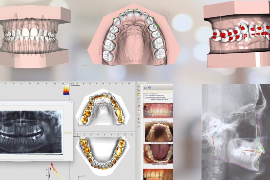 Crown–root set-up supports anatomy-guided planning