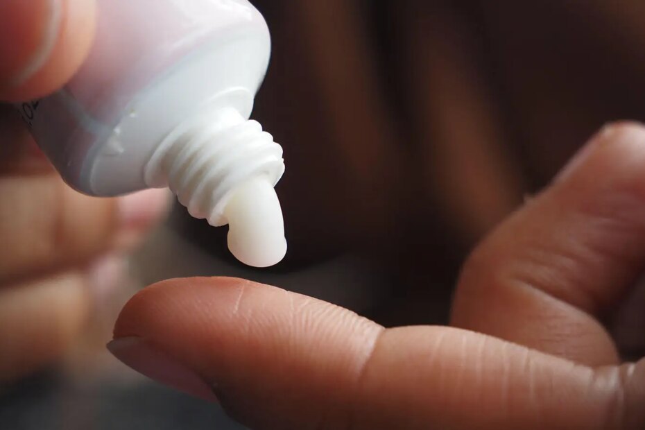 A close-up photo of a woman squeezing lotion from a tube onto her finger.