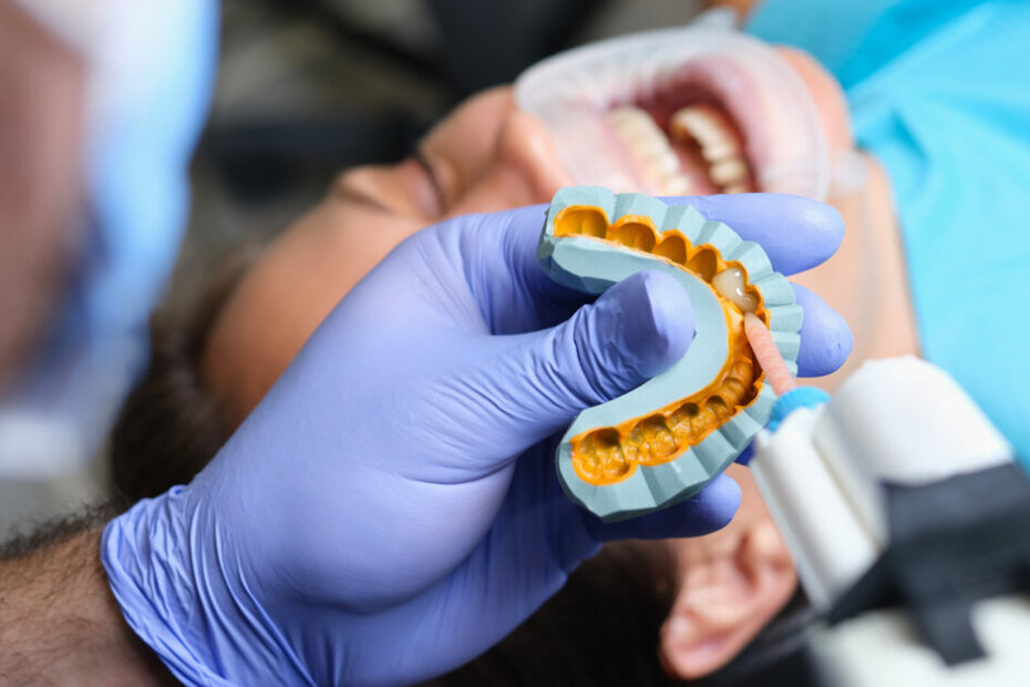 Tokyo dental symposium to explore innovative materials