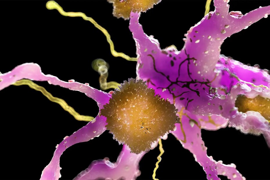 A computer rendering of amyloid plaques forming between neurons.