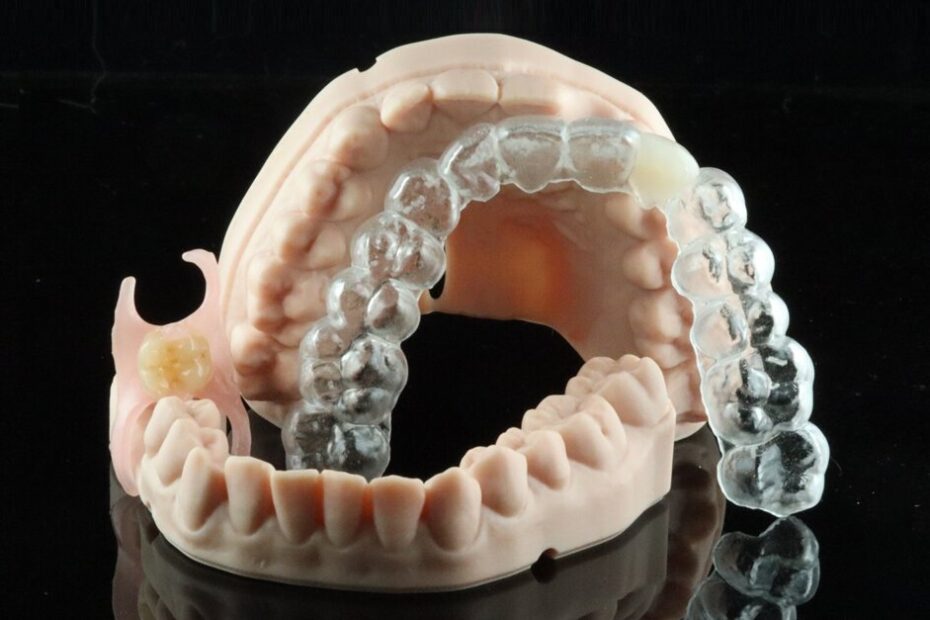 Contemporary provisionalisation with 3D printing
