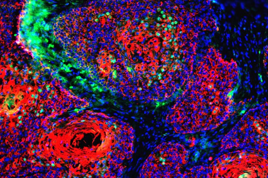 Environmental Factor - August 2023: For clues on cancer, scientists work to decipher exposure fingerprints