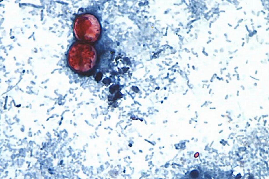 A microscope image of Cyclospora cayetanensis oocysts found in a fresh stool sample.
