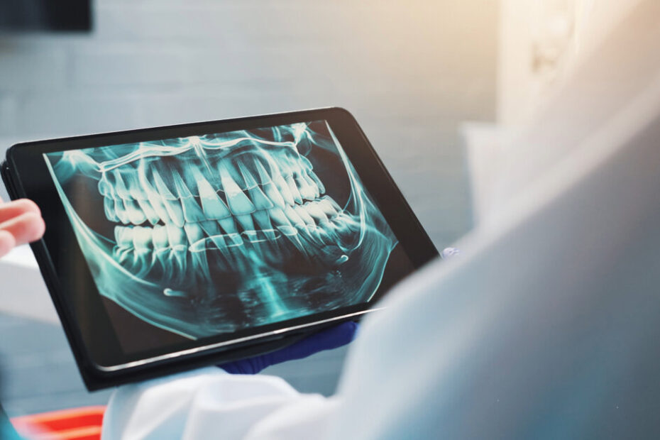 Pearl AI reveals hidden oral health crisis