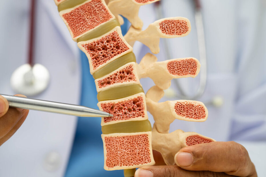 Periodontitis may worsen systemic bone loss, study finds