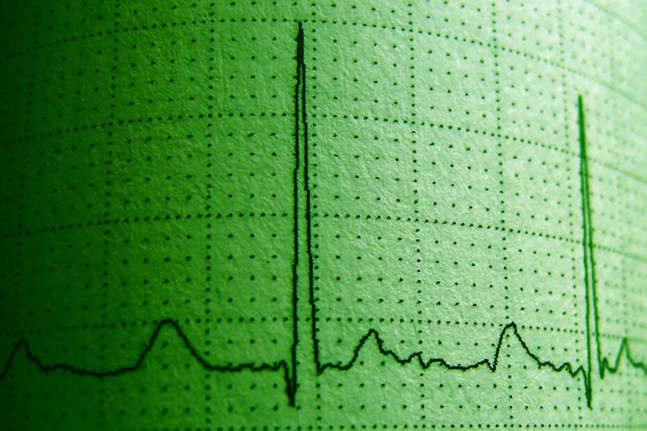 A photo of a green tinted electrocardiogram.