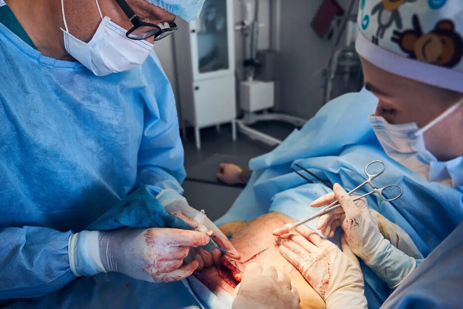 A photo of surgeons performing abdominoplasty.