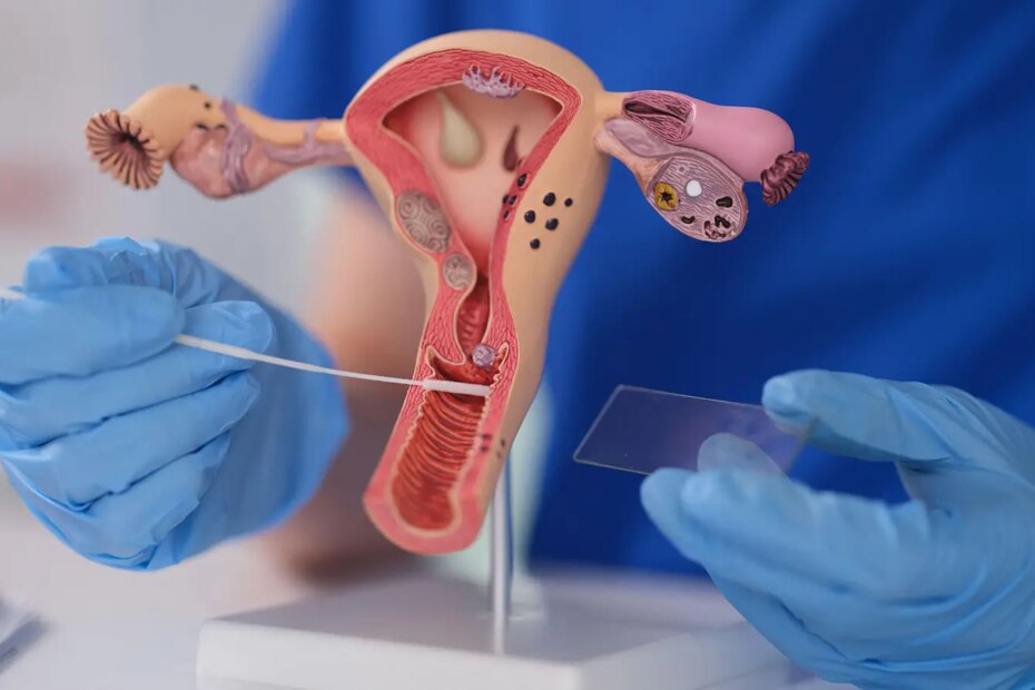 A photo of a female gynecologist demonstrating a cervical swab on an anatomical model.