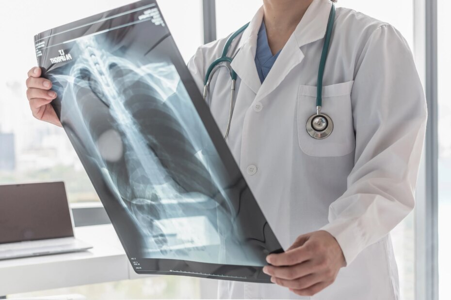 Years After He Quit Smoking, a Lung Cancer Scan Saved His Life