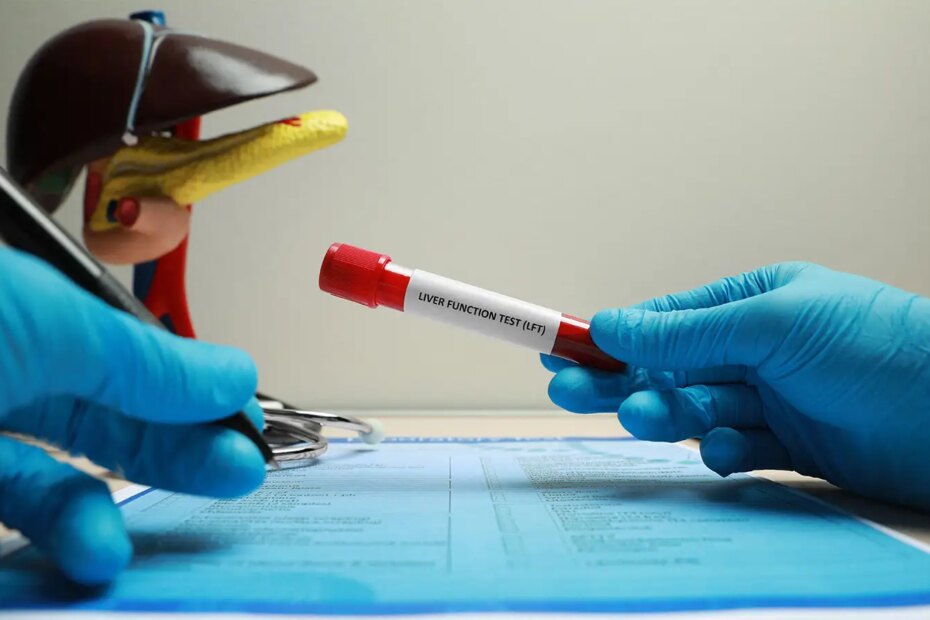 A photo of blue rubber gloved hands holding a pen and a vial of blood labeled: Liver Function Test (LFT) over a test form.